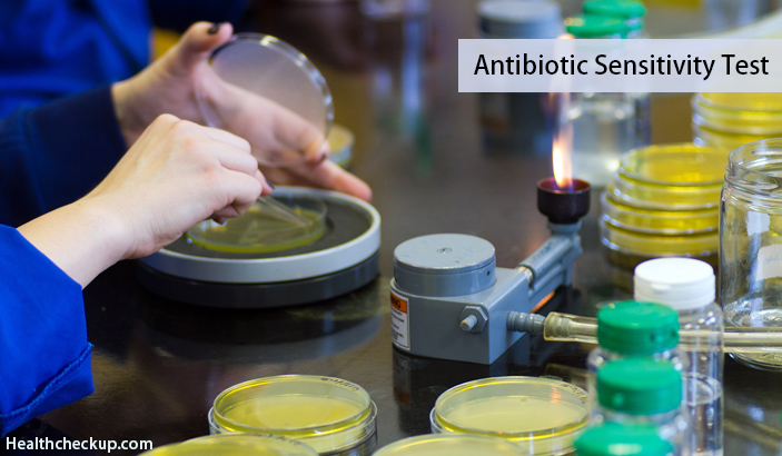 Antibiotic sensitivity test