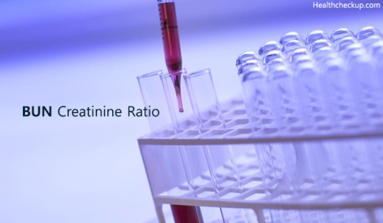 Bun creatinine ratio