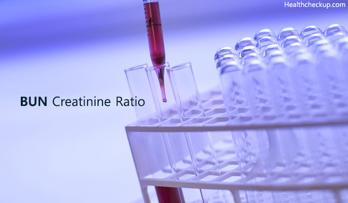 BUN Creatinine Ratio