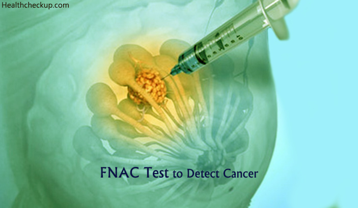 FNAC Test to Detect Cancer