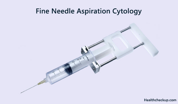 Fine Needle Aspiration Cytology