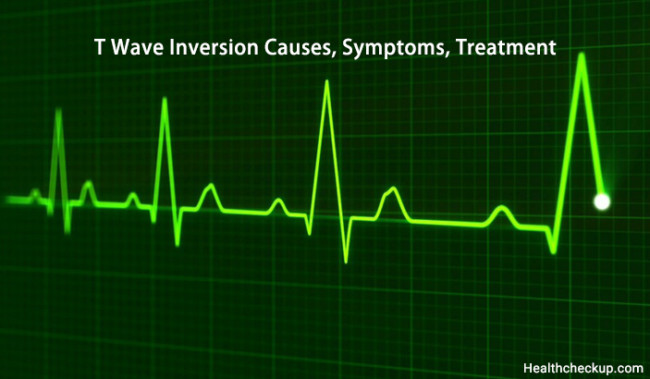 causes of t wave inversion in children