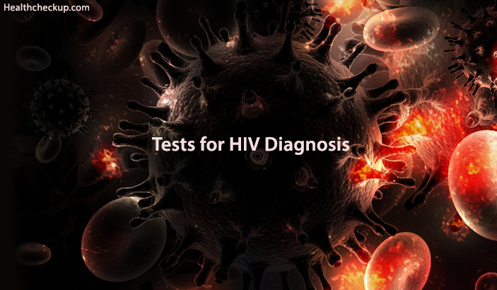 Tests for HIV Diagnosis