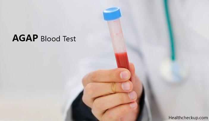 agap blood test