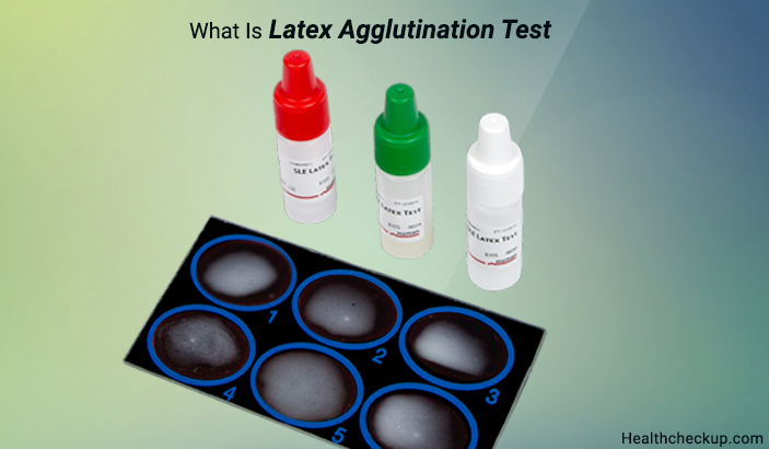 what is latex agglutination test