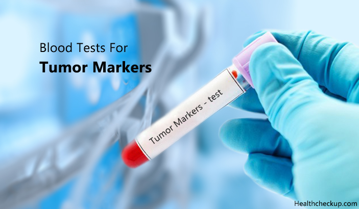 Blood Tests For Tumor or Cancer Markers
