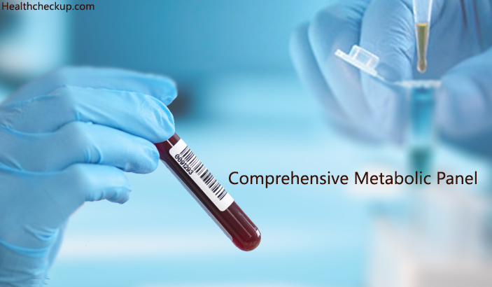 Comprehensive Metabolic Panel