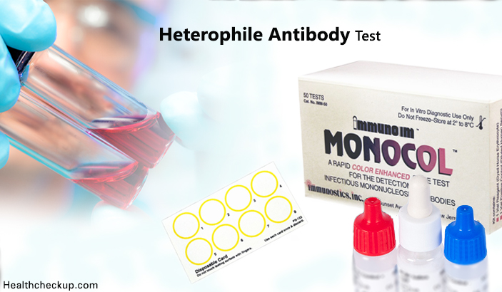 Heterophile Antibody Test
