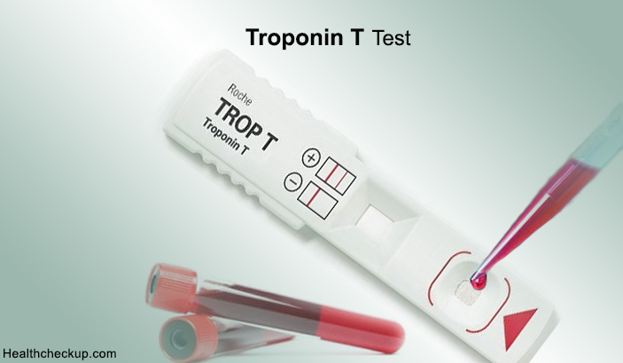 Troponin T Test