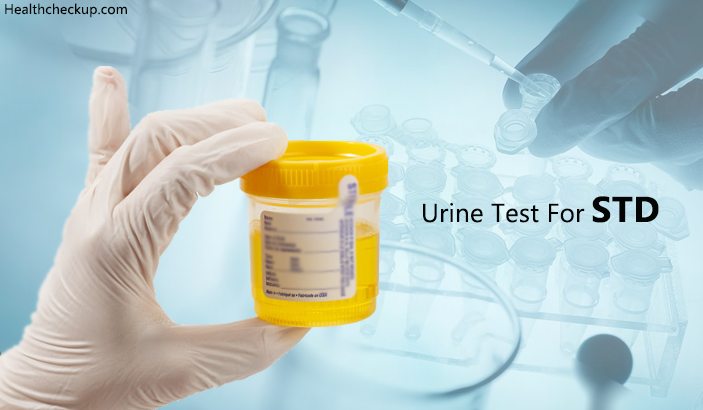 Urine Test For STD