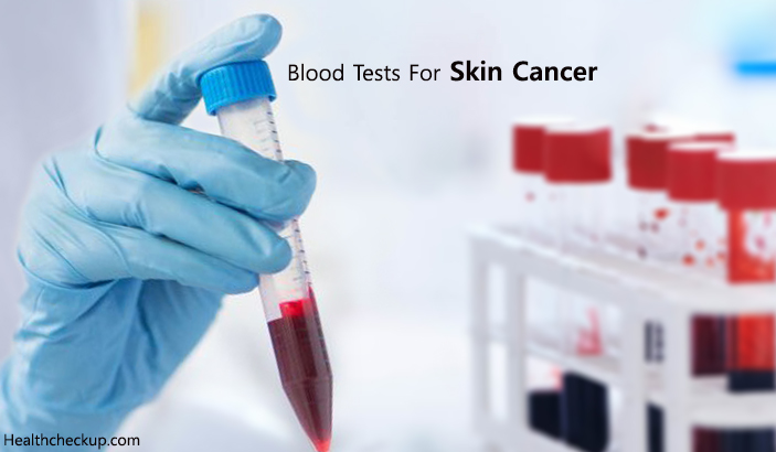 Blood Tests For Skin Cancer