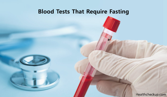 Which Blood Tests Require Fasting