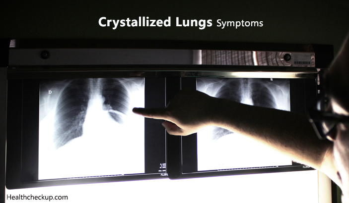 Crystallized Lungs Symptoms, Causes, Treatment