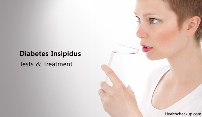 Diabetes Insipidus Tests, Treatment