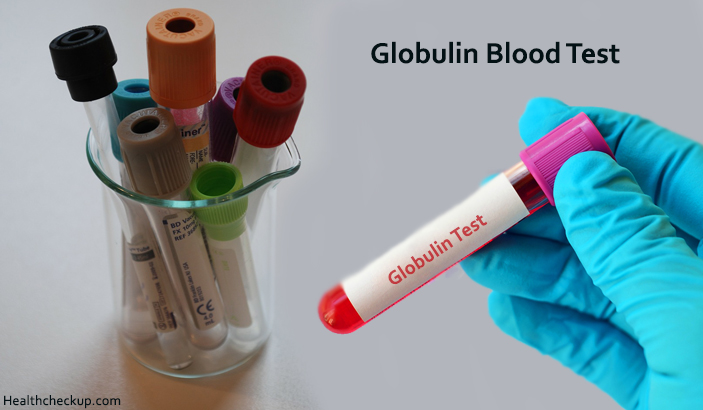 Globulin Blood Test