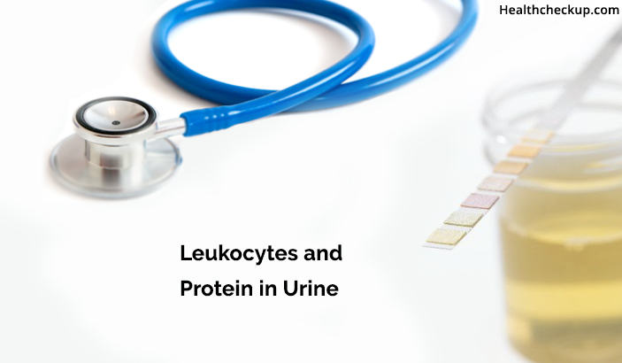 Leukocytes and Protein in Urine