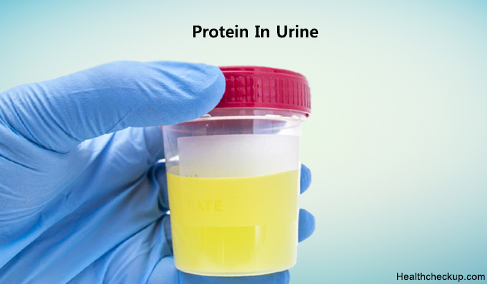 Protein In Urine