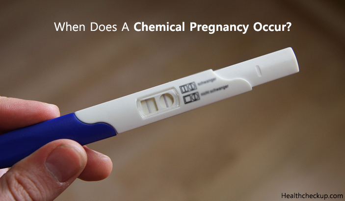 When Does A Chemical Pregnancy Occur