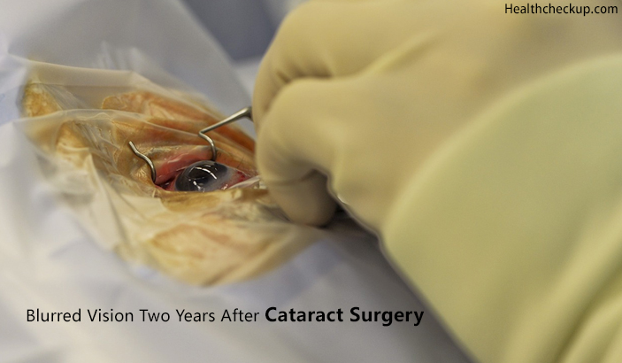 blurred vision two years after cataract surgery