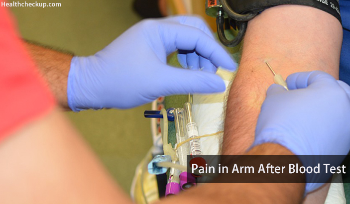 Pain in Arm after Blood Test