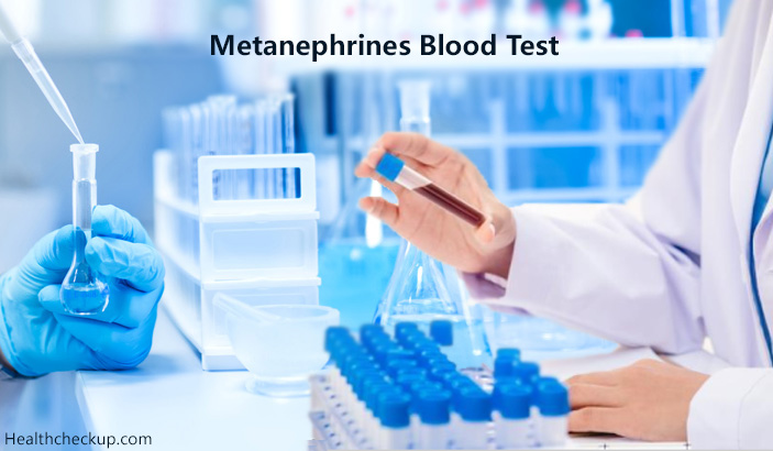 Metanephrines blood test