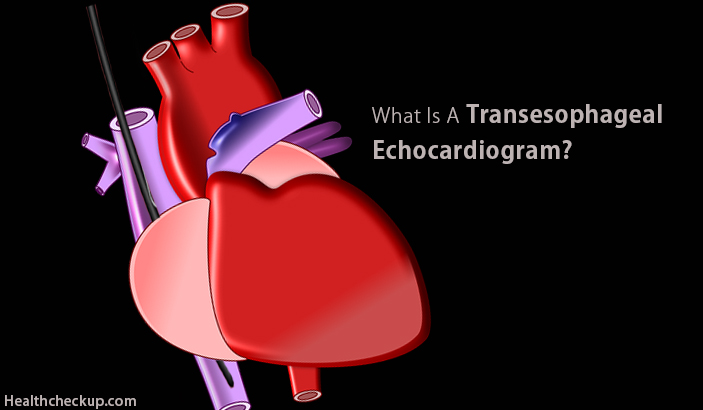 Transesophageal Echocardiogram - Preparation, Procedure, Views, Complications