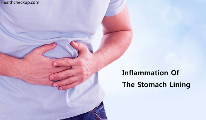Inflammation of Stomach Lining - Gastritis