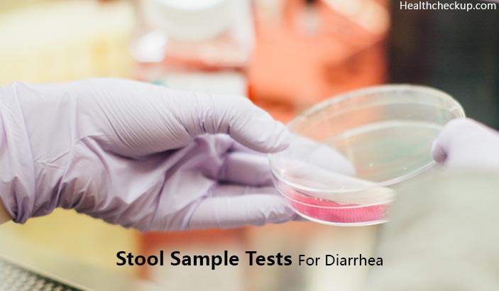 Stool Sample Tests For Diarrhea