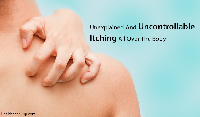 Uncontrollable & Unexplained Itching All Over Body: Causes ...