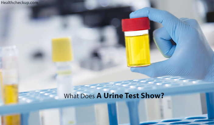 what does a urine test show