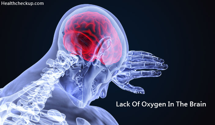 Lack of Oxygen In The Brain Symptoms, Causes, Treatment, Side Effects