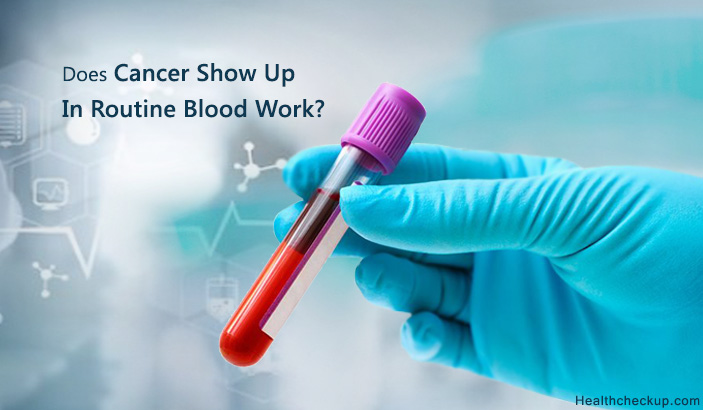 Does Cancer Show Up In Routine Blood Work