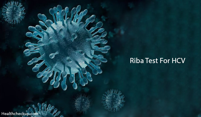 RIBA Test for HCV