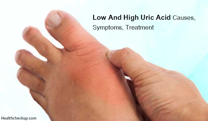 Low and High uric acid causes, symptoms, treatment