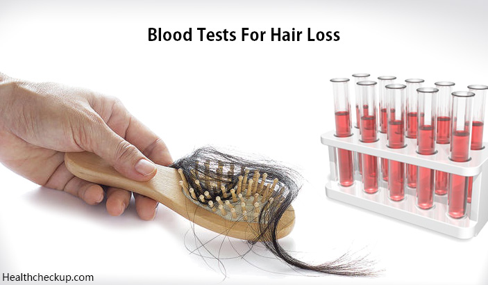 blood tests for hair loss