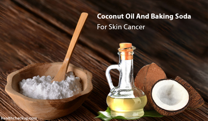 How To Use Coconut Oil And Baking Soda For Skin Cancer