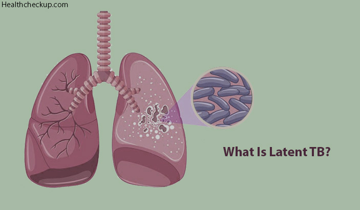 Duration and Side Effects of Latent TB Treatment