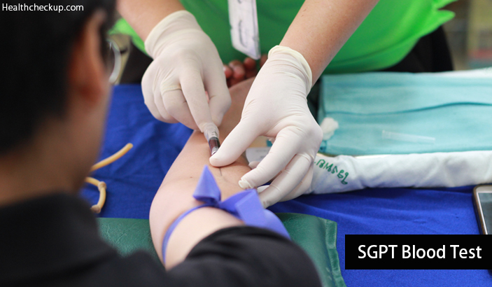 SGPT Blood Test - Procedure, Prep, Results Explanation