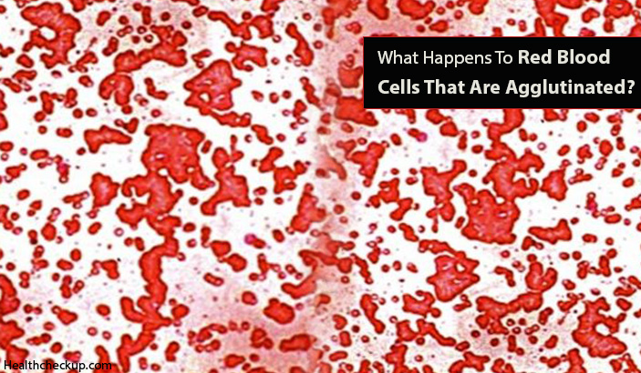 What Happens To Red Blood Cells That Are Agglutinated?