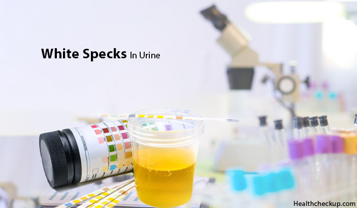 White Specks in Urine - Meaning, Causes, Symptoms, Treatment