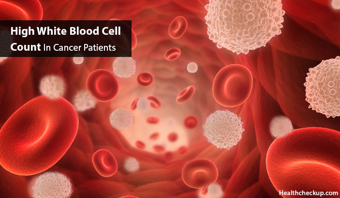 high white blood cell count in cancer patients