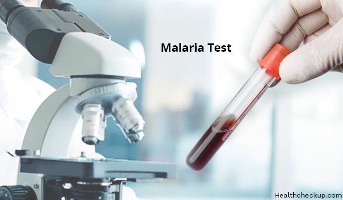 Malaria Test Procedure, Preparation, Principle, Results Interpretation