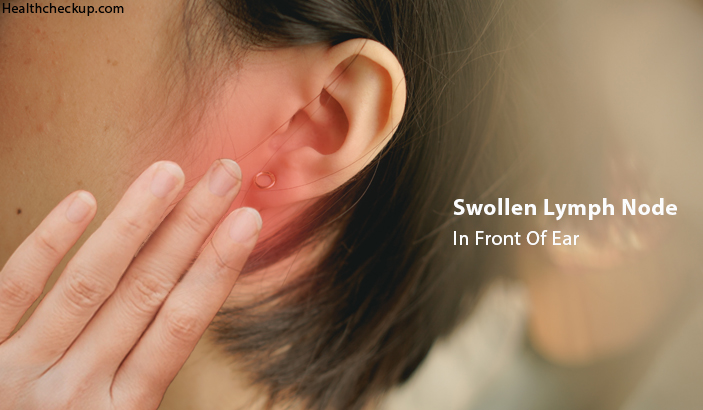 swollen lymph node in front of ear