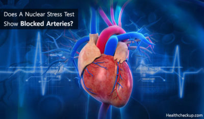 nuclear arteries blocked procedures healthcheckup