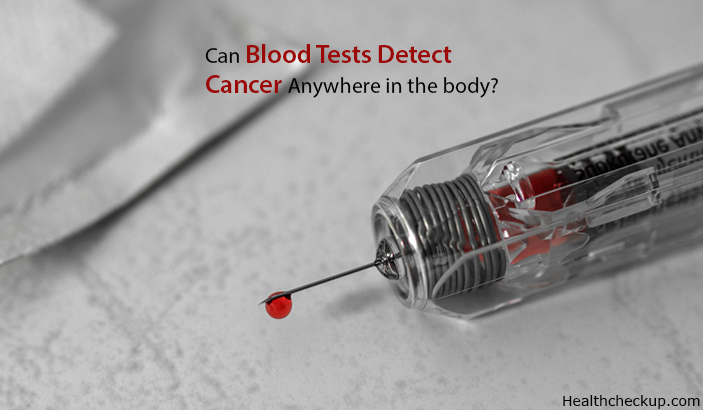 Can Blood Tests Detect Cancer Anywhere in the Body