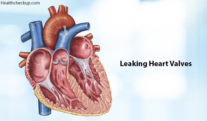 leaking heart valves