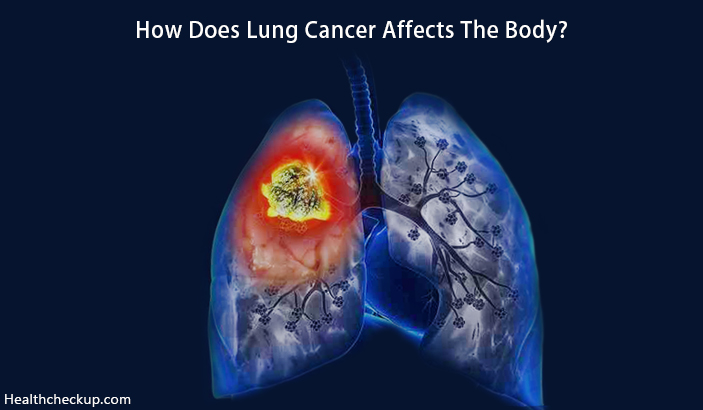 How Does Lung Cancer Affects The Body