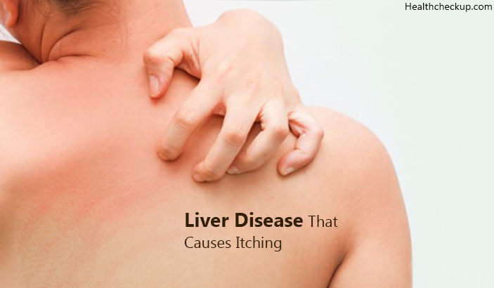 Liver Disease That Causes Itching