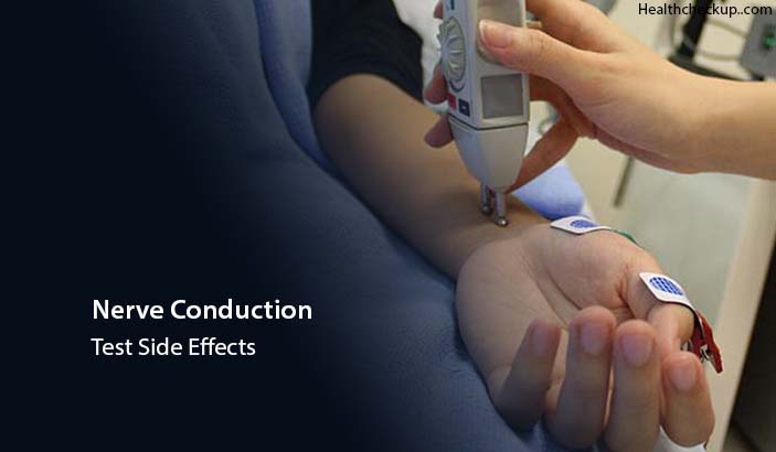 Nerve Conduction Test Side Effects