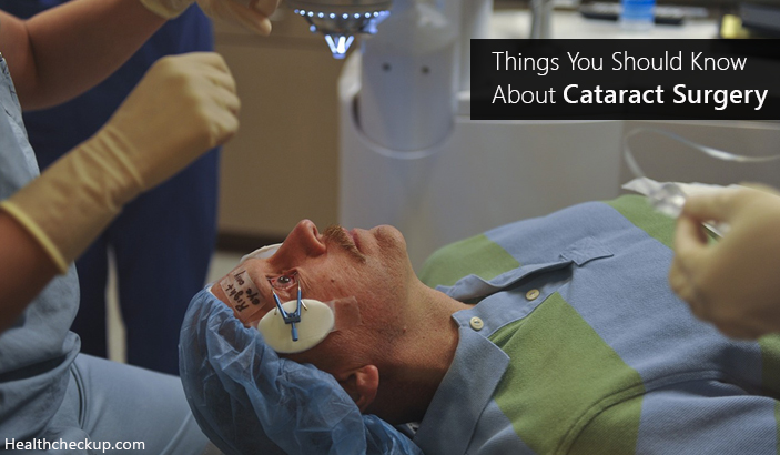 Things you should know about cataract surgery